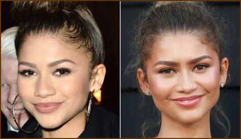 Unveiling The Truth: Zendaya's Plastic Surgery Journey